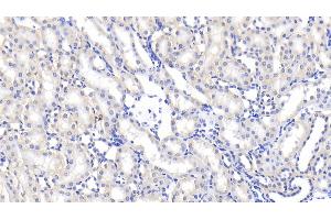 Immunohistochemistry (IHC) image for anti-Lipopolysaccharide Binding Protein (LBP) (AA 226-480) antibody (ABIN7433612)