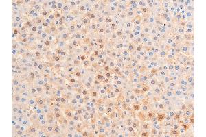 Immunohistochemistry (IHC) image for anti-Checkpoint Kinase 1 (CHEK1) (pSer317) antibody (ABIN6255201)
