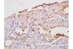 Formalin-fixed and paraffin embedded rat testis labeled with Rabbit Anti PAPK/ALS2CR2 Polyclonal Antibody, Unconjugated (ABIN751273) at 1:200 followed by conjugation to the secondary antibody and DAB staining (STRADB antibody  (AA 251-350))