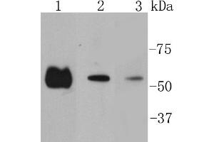 Lane 1: Hela lysates, Lane 2:A431 lysates, Lane 3: PC12 lysates probed with Smad2 (9A3) Monoclonal Antibody  at 1:1000 overnight at 4˚C. (SMAD2 antibody)