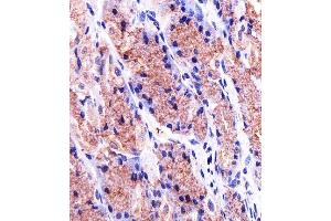 Paraformaldehyde-fixed, paraffin embedded human stomach tissue, Antigen retrieval by boiling in sodium citrate buffer (pH6. (Prohibitin antibody)