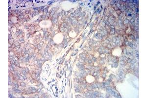 Immunohistochemistry (IHC) image for anti-Fibroblast Activation Protein, alpha (FAP) (AA 26-264) antibody (ABIN7193479)