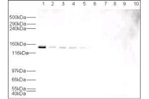 Western blot using  affinity purified anti-HAUSP antibody shows detection of HAUSP in various cell lysates at 130 kDa (lane 1 - HeLa nuclear extract, lane 2 - HeLa, Lane 3 - A431, Lane 4 - MCF7, Lane 5 - 3T3). (USP7 antibody)