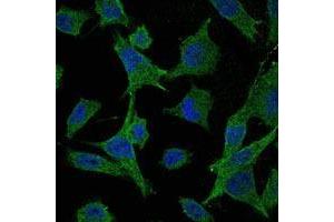 Immunofluorescence (IF) image for anti-Mitogen-Activated Protein Kinase Kinase 6 (MAP2K6) antibody (ABIN969269)
