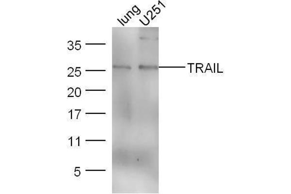 TRAIL anticorps  (AA 185-281)