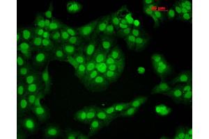 Immunocytochemistry/Immunofluorescence analysis using Mouse Anti-CaMKII Monoclonal Antibody, Clone 6G9 . (CAMKII gamma antibody  (FITC))