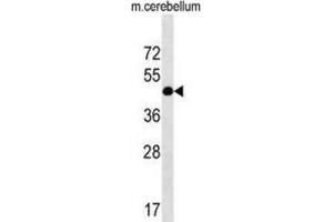 Western Blotting (WB) image for anti-RCD1 Required For Cell Differentiation1 Homolog (RQCD1) antibody (ABIN2999751) (RQCD1 antibody)