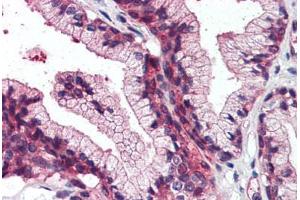 Anti-SLC39A14 antibody  ABIN960809 IHC staining of human prostate. (SLC39A14 antibody  (Cytoplasmic Domain))