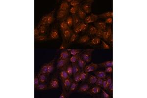 Immunofluorescence analysis of C6 cells using  antibody (ABIN7265416) at dilution of 1:100. (ACBD3 antibody  (AA 1-160))