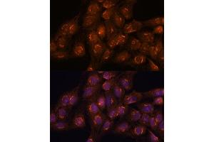 Immunofluorescence analysis of C6 cells using  antibody (ABIN7265416) at dilution of 1:100. (ACBD3 antibody  (AA 1-160))
