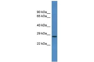 WB Suggested Anti-Caly Antibody Titration:  0. (CALY antibody  (Middle Region))