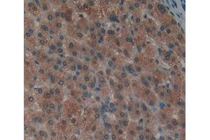 Used in DAB staining on fromalin fixed paraffin- embedded liver tissue (PTPN12 antibody  (AA 1-293))