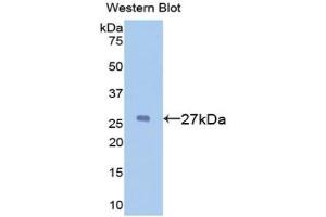 Detection of Recombinant a1BG, Mouse using Polyclonal Antibody to Alpha-1-B-Glycoprotein (a1BG) (A1BG antibody  (AA 313-512))