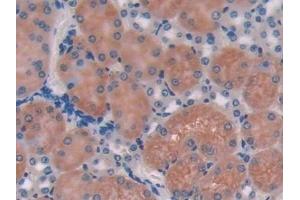 Immunohistochemistry (IHC) image for anti-HLA-DR-gamma (CD74) (AA 64-205) antibody (ABIN7443722)