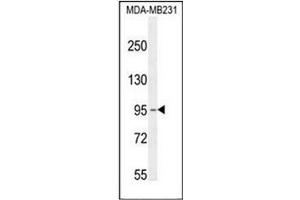 Western blot analysis of KCNT2 / SLICK Antibody (C-term) in MDA-MB231 cell line lysates (35ug/lane).