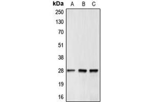 Western blot analysis of BCL2 expression in MCF7 (A), mouse brain (B), rat kidney (C) whole cell lysates.