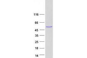 ABLIM2 Protein (Transcript Variant 7) (Myc-DYKDDDDK Tag)