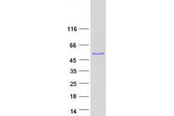 ABLIM2 Protein (Transcript Variant 7) (Myc-DYKDDDDK Tag)