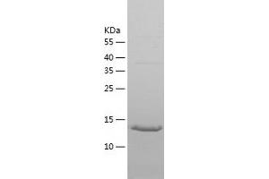 Western Blotting (WB) image for Regulator of G-Protein Signaling 21 (RGS21) (AA 1-152) protein (His tag) (ABIN7287415) (RGS21 Protein (AA 1-152) (His tag))