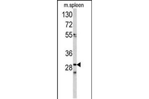 Western blot analysis of CDCA3 antibody in mouse spleen tissue lysates(35ug/lane) (CDCA3 antibody  (N-Term))