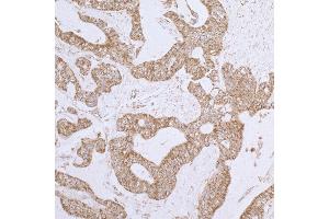 Immunohistochemistry (IHC) image for anti-Dihydrolipoamide Dehydrogenase (DLD) (AA 459-509) antibody (ABIN7453411)