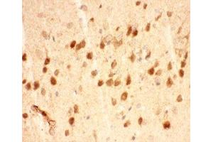 IHC-P testing of mouse brain tissue (BDNF antibody  (AA 129-247))