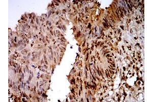 Immunohistochemistry (IHC) image for anti-Transcription Termination Factor, RNA Polymerase I (TTF1) (AA 1-150) antibody (ABIN5542340)