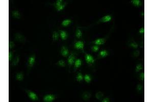 Immunofluorescent staining of HeLa cells using anti-KRT19 mouse monoclonal antibody (ABIN2452318). (Cytokeratin 19 antibody  (AA 240-390))
