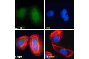 ABIN185179 Immunofluorescence analysis of paraformaldehyde fixed U2OS cells, permeabilized with 0. (TIGD1 antibody  (C-Term))