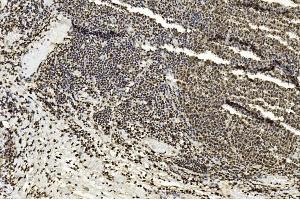 Immunohistochemical analysis of paraffin-embedded Human tonsil section using Pink1 am1836a. (EZH2 antibody)