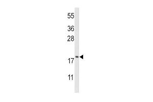 Western blot analysis of CFL1 Antibody (Center) (ABIN650759 and ABIN2839516) in HL-60 cell line lysates (35 μg/lane). (Cofilin antibody  (AA 70-98))