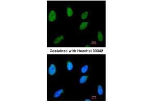 ICC/IF Image Immunofluorescence analysis of paraformaldehyde-fixed HeLa, using RAD54B, antibody at 1:100 dilution. (RAD54B antibody  (C-Term))