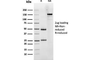 SDS-PAGE Analysis Purified LHCGR Mouse Monoclonal Antibody (LHCGR/1417). (LHCGR antibody  (AA 70-410))