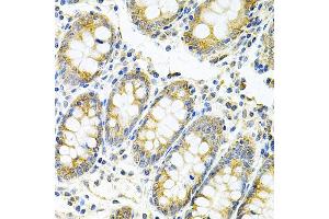 Immunohistochemistry of paraffin-embedded human colon using MyD88 Antibody (ABIN6128257, ABIN6144228, ABIN6144229 and ABIN6213986) at dilution of 1:100 (40x lens). (MYD88 antibody  (AA 60-309))