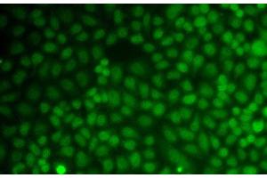Immunofluorescence analysis of A549 cells using GADD45A Polyclonal Antibody (GADD45A antibody)