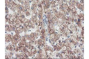 Immunohistochemical staining of paraffin-embedded Human liver tissue using anti-CYP2J2 mouse monoclonal antibody. (CYP2J2 antibody)
