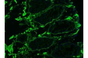 Image no. 1 for anti-Collagen, Type IV (COL4) antibody (ABIN959465) (Collagen IV antibody)