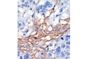 Image no. 2 for anti-Phosphatidylinositol-4-Phosphate 5-Kinase, Type I, gamma (PIP5K1C) (C-Term) antibody (ABIN360481) (PIP5K1C antibody  (C-Term))