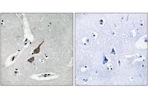 Immunohistochemistry analysis of paraffin-embedded human brain tissue, using GRID1 Antibody. (GRID1 antibody  (AA 831-880))