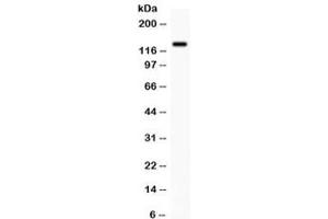 Western blot testing of human SW620 cell lysate with CDCP1 antibody.