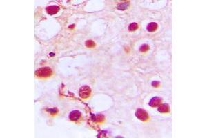 Immunohistochemical analysis of ZNF76 staining in human testis formalin fixed paraffin embedded tissue section. (ZNF76 antibody  (Center))
