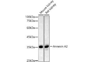 Western blot analysis of extracts of various cell lines, using Annexin  antibody  at 1:500 dilution. (Annexin A2 antibody)