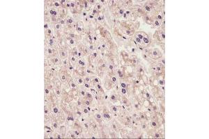 staining IL1R in human liver tissue sections by Immunohistochemistry (IHC-P - paraformaldehyde-fixed, paraffin-embedded sections). (IL1RAP antibody  (AA 279-313))