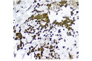 IHC analysis of NMI using anti-NMI antibody (ABIN3043451). (NMI antibody  (AA 2-307))