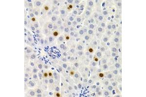 Immunohistochemistry of paraffin-embedded rat liver using GEMIN2 Antibody.