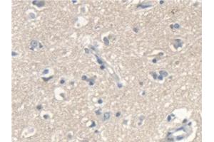 Detection of SCARA5 in Human Cerebrum Tissue using Polyclonal Antibody to Scavenger Receptor Class A Member 5 (SCARA5) (SCARA5 antibody  (AA 118-495))
