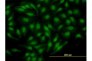 Immunofluorescence of monoclonal antibody to NR4A2 on HeLa cell. (NR4A2 antibody  (AA 71-170))