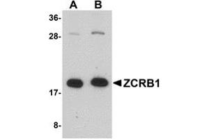 Western Blotting (WB) image for anti-Zinc Finger CCHC-Type and RNA Binding Motif 1 (ZCRB1) (C-Term) antibody (ABIN1030818) (ZCRB1 antibody  (C-Term))