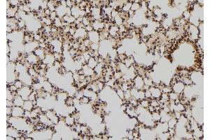 Immunohistochemistry (IHC) image for anti-Heat Shock Protein 90kDa alpha (Cytosolic), Class A Member 1 (HSP90AA1) (C-Term) antibody (ABIN6262402)