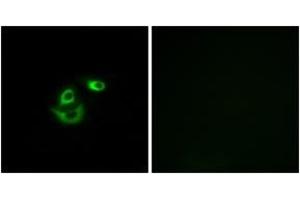 Immunofluorescence analysis of A549 cells, using CLCC1 Antibody. (CLCC1 antibody  (AA 391-440))